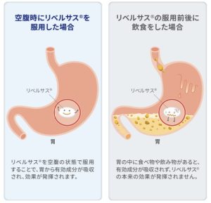 リベルサスを空腹の状態で服用する理由