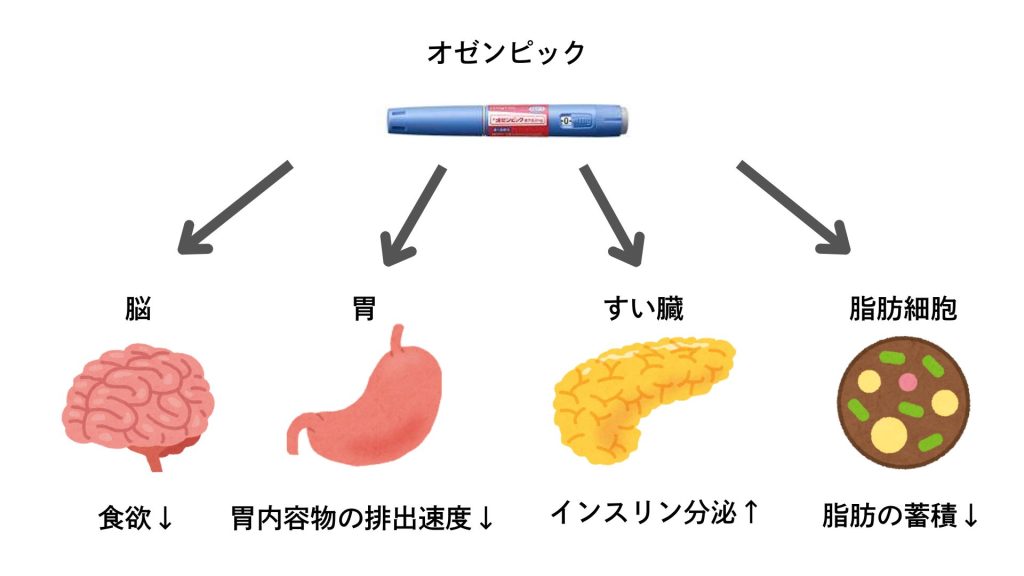 オゼンピックのダイエット効果