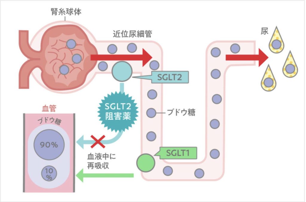 SGLT-2阻害薬の仕組みと効果